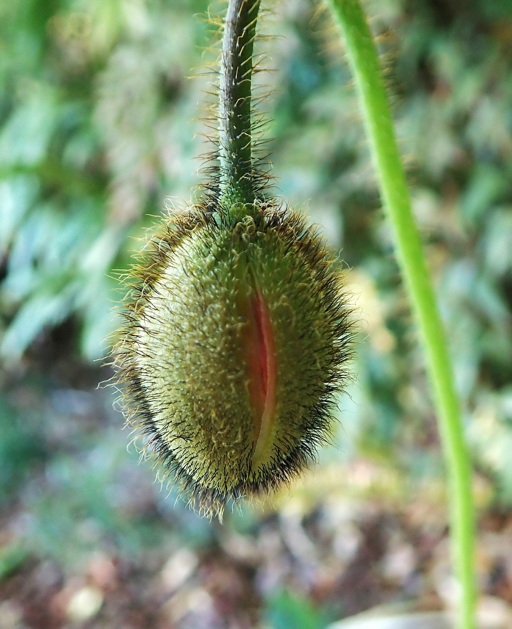 植毛の値段はどのくらいかかるの？