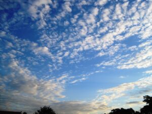 植毛の金額はどのくらいかかるの？