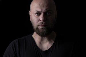 若ハゲを改善して髪を生やしたい方法は？