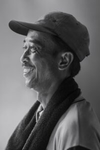 若ハゲは治るのか？その可能性と対策を徹底解説！