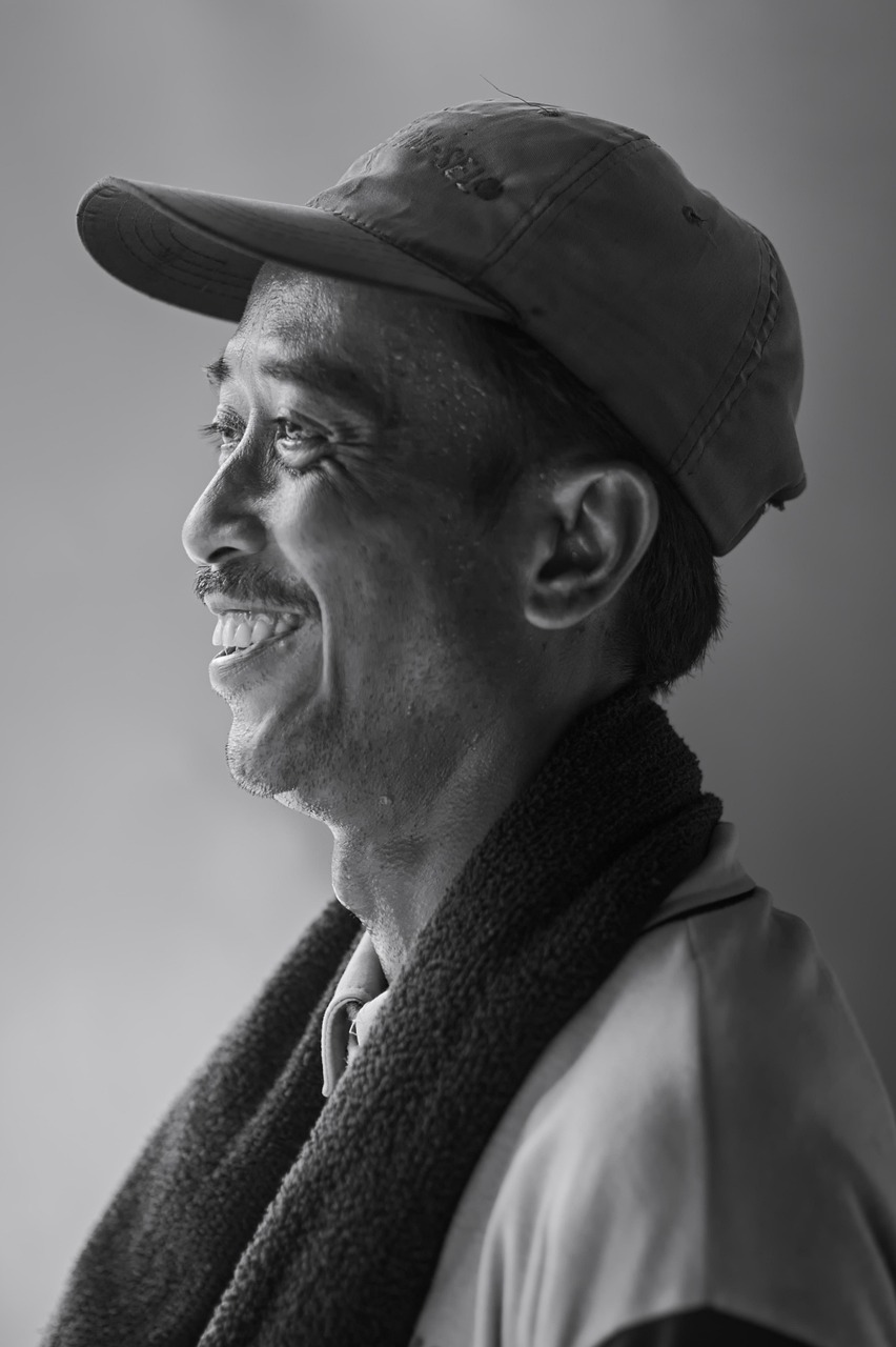 若ハゲは治るのか？その可能性と対策を徹底解説！