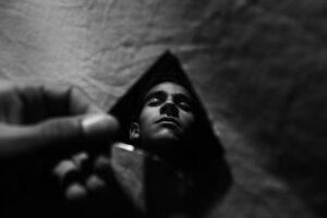 若ハゲをチェックする方法はどのようなものがある？