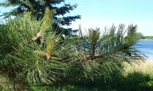 自毛植毛でAGAを止まらない悩みを解消する方法は？