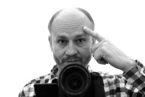 自毛植毛の費用を安く抑えるためのポイントは？