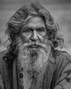 自毛植毛をした50代男性のリアルな体験談とは？