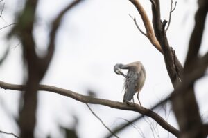 京都での自毛植毛の体験談は本当に役立つ？