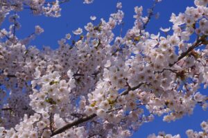 札幌で自毛植毛をするならおすすめのクリニックはどこ？